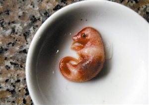 6684pangolin_fetus