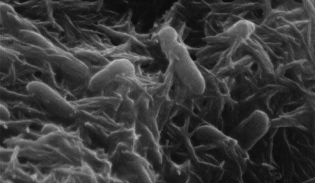 Shewanella oneidensis bacteria