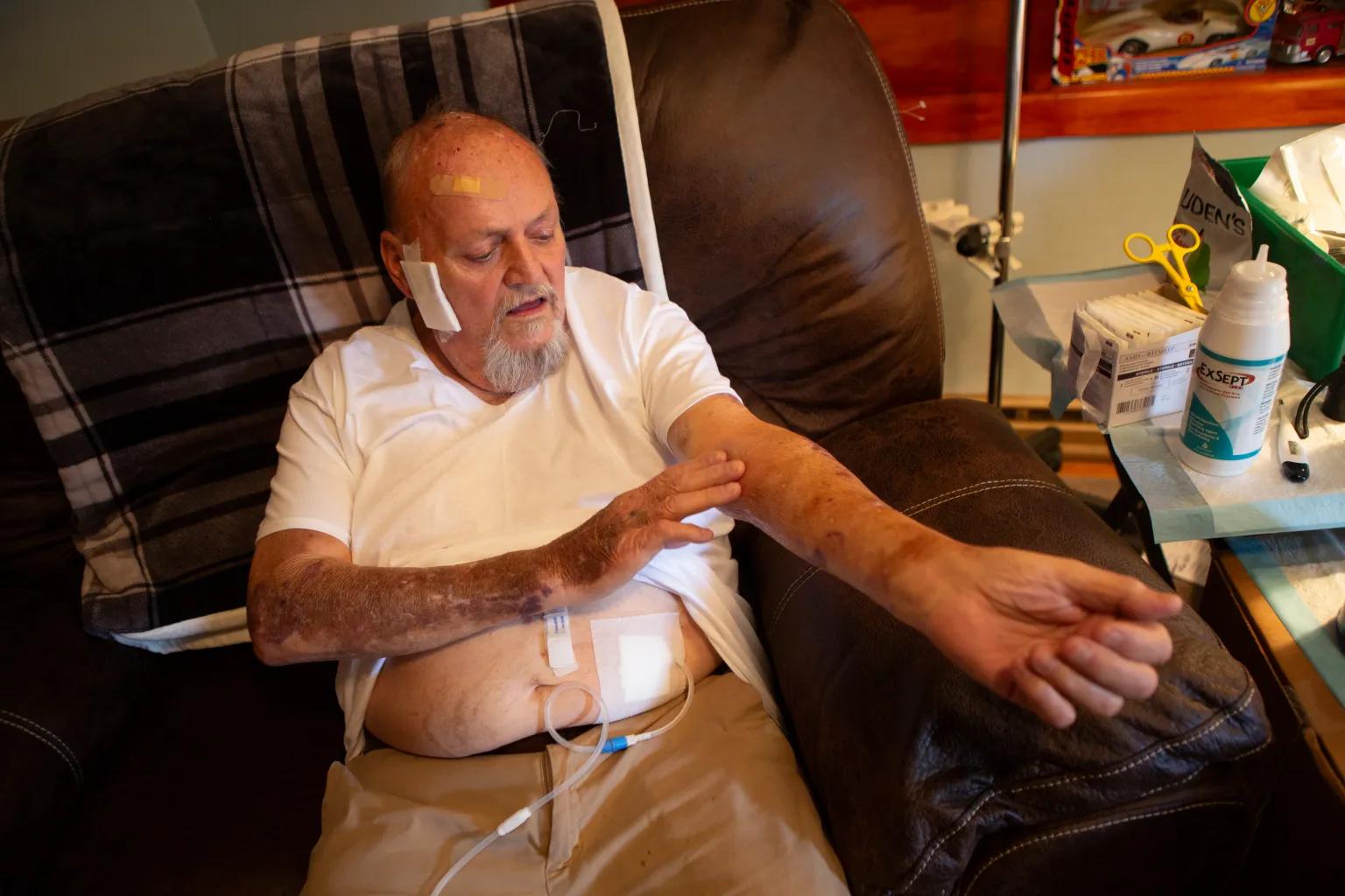 An older man in a white shirt sits in a chair hooked up to a machine.